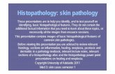 Histopathology: skin pathology · common skin pathologies. Before viewing this presentation you are advised to review relevant histology, sections on inflammation, healing, neoplasia,