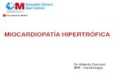 MIOCARDIOPATÍA HIPERTRÓFICA · Functional obstruction of the left ventricle (acquired aortic subvalvar stenosis). Russell Claude Brock Guys Hosp Rep, 106 (1957), p. 221