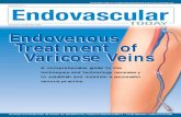 Supplement to November/December 2004 Endovenous Treatment …1104Suppl)_diomed.pdf · NOVEMBER/DECEMBER 2004I SUPPLEMENT TO ENDOVASCULAR TODAY I 3 Endovenous Treatment of Varicose