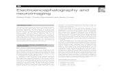 Electroencephalography and neuroimaging · neuroimaging will be discussed in this chapter. ELECTROENCEPHALOGRAPHY IN PSYCHIATRY The normal electroencephalogram An electroencephalogram