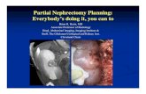 Partial Nephrectomy Planning: Everybody’s doing it, …...Partial Nephrectomy Planning: Everybody’s doing it, you can to Brian R. Herts, MD Associate Professor of Radiology Head,