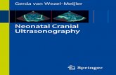 Gerda van Wezel-Meijler Neonatal Cranial Ultrasonographymedia.hugendubel.de/shop/coverscans/114PDF/11430092... · 2015-09-02 · erature. All ultrasound images were performed at the