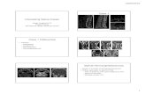 Case 1 Interesting Spine Casesdistribute.cmetoronto.ca/MIM1202/1002-1100-Yeung-Spinal... · 2012-09-26 · 20/09/2012 1 Interesting Spine Cases Organ Imaging 2012 Robert Yeung Sunnybrook