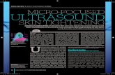 SkIn TIghTenIng Micro-Focused ultrasound · Micro-focused ultrasound, skin lifting, skin tightening, superficial musculoaponeurotic system, collagen, face, neck ABsTrACT The only