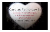 Cardiac Pathology 3 - WordPress.com · 14/10/2016  · Cardiac Pathology 3: Valvular Heart Disease, Cardiomyopathies, and Tumors Kris>ne Kras, M.D. • Blood Vessels