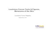 Louisiana Cancer Facts & Figures, Melanoma of the … › wp-content › uploads › 2017 › 10 › ...Louisiana Cancer Facts & Figures, Melanoma of the Skin Louisiana Tumor Registry