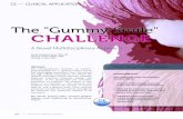 The Gummy Smile CHALLENGE - DRTH.CO.UK · Gummy Smile An esthetically pleasing smile comprises many factors, including balanced upper and lower lip lines, healthy gingivae, correct