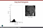 Gray level histograms - Stanford University · Histogram equalization based on a histogram obtained from a portion of the image [Pizer, Amburn et al. 1987] Sliding window approach: