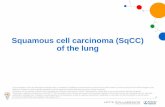 Squamous cell carcinoma (SqCC) of the lung€¦ · 3 Lung cancer incidence • Lung and bronchial cancer has been the most common cancer in the world for decades1 • In 2012, it
