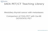 Medullary thyroid cancer with metastases Comparison of FDG … · 2015-09-03 · • For medullary thyroid carcinoma 68Ga DOTATATE PET/CT may be useful as a complementary modality