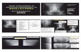 Basic Interpretation of Abdominal Radiographs (1) · The diagnosis was abdominal aortic aneurysm (AAA). 25 25225 5 Intra-abdominal calcifications • Calculi • Vascular ... (2005-05-15):