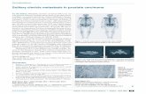 Solitary clavicle metastasis in prostate carcinoma M …5. Ansari MS, Nabi G, Aron M. Solitary radial head metastasis with wrist drop: a rare presentation of metastatic prostate cancer.
