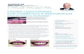 CROWN LENGTHENING FOR COSMETICS & RESTORATION€¦ · surgical instruments, high speed handpiece, and a pig mandible will be provided for each participant. includes full colour surgical