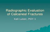 Radiographic Evaluation of Calcaneal Fracturesbonepit.com/Lectures/Radiographic Evaluation of Calcaneal Fracture… · Intra-Articular Fractures of the Calcaneus: Present State of