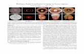 Multiview Radial Catadioptric Imaging for Scene Capturesujit/Papers/Kuthirummal_TOG06.pdf · Sujit Kuthirummal Shree K. Nayar Columbia University (a) (b) (c) (d) (e) ... dial imaging