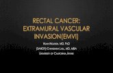 RECTAL CANCER: EXTRAMURAL VASCULAR INVASION(EMVI) · Neoadjuvant Treatment in Rectal Cancer. British Journal of Cancer 110.1 (2014): 19–25. PMC. Web. 19 Feb. 2017. • Deprisco