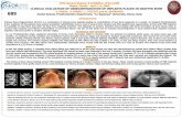Dental School, Prosthodontics Sapienza - Dr Stefano …Miami, Florida - April 1 - 4, 2009 CLINICAL EVALUATION OF OSSEOINTEGRATION OF IMPLANTS PLACED IN GRAFTED BONE I. VOZZA, S. ROSSI*