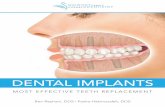 DENTAL IMPLANTS - Local Dentist for You & Your …...WHY YOU SHOULD AVOID “CHEAP” DENTAL IMPLANTS Much like all other low-cost products, for creating structural or aesthetic improvements