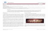 D e n tis ry Dentistry - Longdom€¦ · The prepared teeth were cleaned and the veneers were tried-in using a transparent try-in paste (Variolink Veneer try-in paste, Ivoclar). The