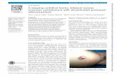 CASE REPORT A weeping umbilical hernia: bilateral ovarian ... · A young woman was referred to us for the management of an umbilical hernia with macerated overlying skin through which