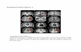 Supplemental Figure 1 - The Journal of Neuroscience€¦ · Supplemental Figure 1 Axial and coronal T1-weighted anatomical MRI scans at the approximate level of maximum infarct volume