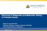 Advances in Diagnostic and Molecular Testing in Prostate Cancerprostatehealthed.org/ASUMMIT/RossSession1AAM.pdf · 2015-09-24 · Screening and Diagnosis – Reducing Over Diagnosis