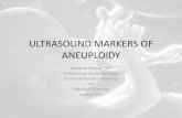 ULTRASOUND MARKERS oF ANEUPLOIDYgynecology.sbmu.ac.ir/uploads/dr.amjadi2.pdf · •For detection of Down syndrome, the genetic sonogram alone : have sensitivity :59 to 87 % positive