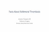 Facts About Iliofemoral Thrombosis · Acute DVT was found in 14.8% of patients (85/576) 26 patients (30%) had isolated calf DVT 45 patients (53%) had femoropopliteal DVT 14 patients