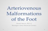 Arteriovenous Malformations of the Foot · during Embolotherapy of Arteriovenous Malformations of the Extremities J . Vasc Interv Radiol 2010; 21:81–89. 9. Peters ZJ, Tan K, Simons