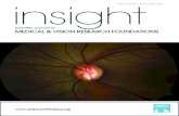 Scientiﬁ c Journal of MEDICAL & VISION RESEARCH … Files... · 2015-07-08 · recession, pigment dispersion syndrome and endogenous hypercortisolism (5–10). Steroid responsiveness