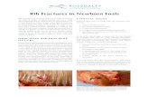Rib Fractures in Newborn Foals - Rossdales Veterinary Surgeons...Rib fractures are common injuries in foals at around the time of birth: A study carried out on a large Thoroughbred