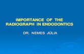 IMPORTANCE OF THE RADIOGRAPH IN ENDODONTICS±sanguj.pdf · THE OBJECTIVE OF OBTURATION: is to create a complete seal along the length of the root canal, from coronal opening to the