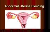 Abnormal Uterine Bleeding - University of Babylon · Bleeding of Endometrial Origin BEO (dysfunctional uterine bleeding DUB). the principal factors implicated in the pathogenesis