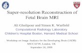 3D Fetal MRI Reconstructiondepts.washington.edu/bicg/documents/MICCAI-2009-IADB-Gholipour.… · What is the current fetal MRI practice? •Single-shot fast spin echo (SSFSE) imaging