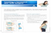Treating a herniated disc with surgery · Treating a herniated disc with surgery 1 You will soon have surgery for a herniated disc. This sheet explains what is involved in this surgery,