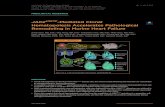JAK2V617F-Mediated Clonal Hematopoiesis Accelerates ... · lonal hematopoiesis of indeterminate poten-tial (CHIP) or age-related clonal hematopoie-sis (ARCH) is a prevalent condition