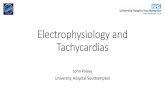 Electrophysiology and Tachycardias - BJCA) Horizons · a narrow complex tachycardia consults regarding treatment. ECG in sinus is normal, echo shows a structurally normal heart. She