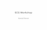 ECG Workshop - GP CME CME/Friday/Ball2 1100 Ikram - EKG.pdf · 2010-08-08 · "Early Repolarisation Syndrome" "High take-off ST segment" trial Fibrillatio vs . Tachycardia (HR >