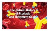 The Natural History of Psoriasis and Treatment Goalsmedia.mycme.com/documents/95/w14-102_psa_module2... · Psoriasis Impact on Quality of Life ((QoLQoL)) Compared to Other Major Morbidities
