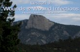 Lesson 8: Wounds and Wound Infectionsbsa-troop139.org/Docs/Lesson 8 Wounds and Wound Infections.pdf · Care/Prevention of Friction Blisters/Chafing •Friction blisters result from
