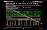 Breast Cancer Grading · Breast Cancer Grading Nottingham Criteria Accurate grading of invasive breast cancer requires good ﬁxation, processing, section cutting, staining and careful