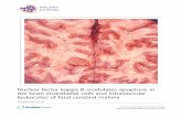 Nuclear factor kappa B modulates apoptosis in the brain … · 2017-04-06 · RESEARCH Open Access Nuclear factor kappa B modulates apoptosis in the brain endothelial cells and intravascular