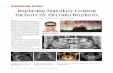 Replacing Maxillary Central Incisors by Zirconia Implants - Imperial Dental · clinical examination and evaluation of OPG and CBCT, it was indicated that restorabili - ty of both
