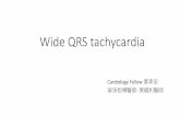 Wide QRS tachycardia rea… · RBBB pattern • qR, Rs or Rrl in VI Frontal plane axis range from +90 degrees to —90 degrees Typical RBBB Precordial leads I-BBB pattern R in VI