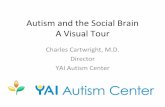 Autism and the Social Brain - YAI: Seeing Beyond Disability · • Social brain is the interaction and connection of multiple neurological structures integrating information to enable