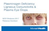 Plasminogen Deficiency Ligneous Conjunctivitis & Plasma ... · References 18 Marks DC1, Fisher J2, Mondy P2, Segatchian J3, Dennington PM2.Serum eye drop preparation in Australia: