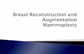 The breast has become a major part of the · 2016-11-07 · As an alternate to revising the reconstructed breast, or sometimes in addition to it, procedures are also performed on