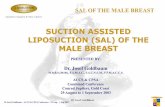 SUCTION ASSISTED LIPOSUCTION (SAL) OF THE …...Conrad Jupiters, Gold Coast 29 August to 1 September 2003 Dr Josef Goldbaum – ACCS & CPSA Conference – 29 Aug – 1 Sep 2003 SAL