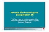 Guidelines for the interpretation of the neonatal ......Rae lbpml 93.154 91-159 It 231 107.182 11491 Fmtal ORS (d egr—' to *197 to +187 p wave Normal neonatal ORS ECG standards RVs