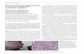 Disseminated Emergomycosis in a Person with HIV widely ... · Thilo Gambichler, Eva Hadaschik, Stefan Esser, Peter-Michael Rath, Gerhard Haase, Dunja Wilmes, Ilka McCormick-Smith,